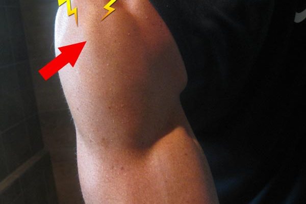 Working out through injuries