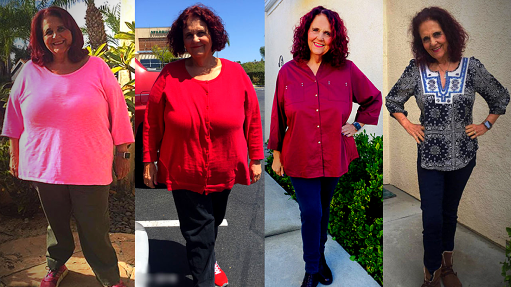Judi's 200 Pound Weight Loss Results